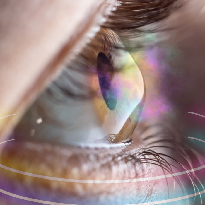 Apikal KE | Hibrit Lens